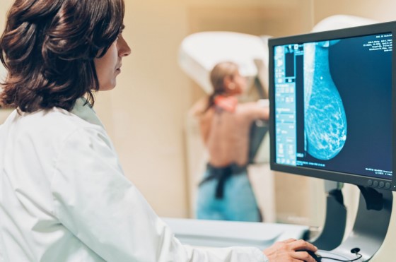 You are currently viewing Mammograms and Pregnancy: What You Need to Know